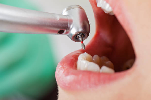 Best Mobile Emergency Dentist in Lipatria, CA
